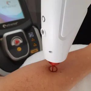 Laser Therapy - Coming Soon